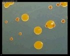 Chryseobacterium indologenes and actinomycete